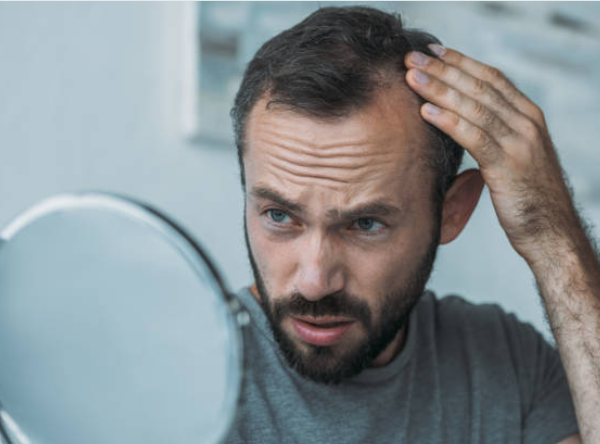 man touching his hair and looking into mirror surprised to see signs of hair loss